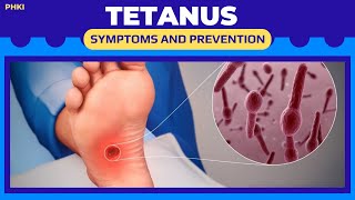 TETANUS causes symptoms and prevention [upl. by Buseck378]