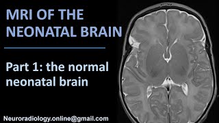 MRI of the Neonatal Brain part 1 the normal neonatal brain [upl. by Ytsim]