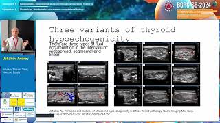 Ushakov AV Pathogenesis of thyroid stromal swelling  BGRSSB2024 [upl. by Eadwina597]