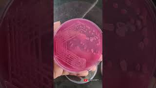 MacConkey agar  lactose fermenting bacteria  pink color colonies Microbiology Differential media [upl. by Adaj261]