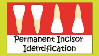 Teeth Identification  Permanent Incisors [upl. by Hanny]