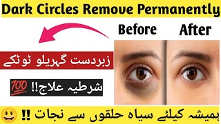 Remove Dark Circles Permanently  How To Get A Rid Of Dark Circles At Home 💯 Results In Few Days [upl. by Gerc]