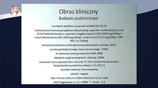 Osteoporoza kiedy leczenie może być groźniejsze od samej choroby [upl. by Harvie202]