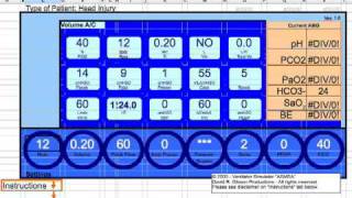 Ventilator Management of the Head Injury [upl. by Fennie659]