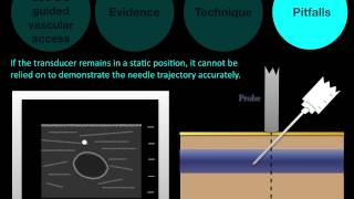 Basic US Course Ultrasound guided vascular Access [upl. by Ednalrim]