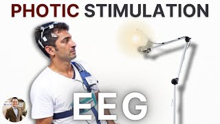 Photic Stimulation on EEG  4 Facts You Need to Know [upl. by Aicram]