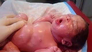 New born premature low birth weight18kg baby having a teeth baby is beautifull cleaning done💞🥰🥰🥰🥰 [upl. by Ronel]