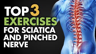 Top 3 Exercises for Sciatica and Pinched Nerve [upl. by Milzie828]