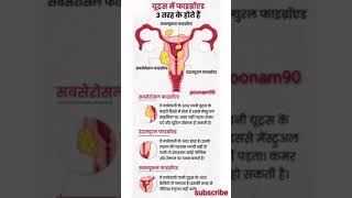 बचेदानी में गांठ fibroid uterus गर्भाशय रसौली pregnancy shortvideo [upl. by Napier732]