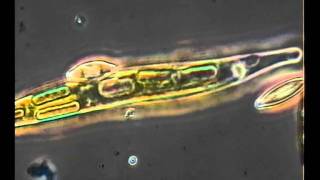 EUGLENA ACUS [upl. by Suzanne]