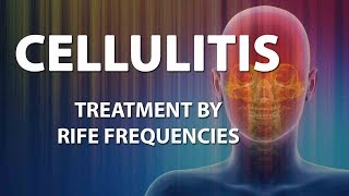 Cellulitis Bacterial infection  RIFE Frequencies Treatment  Energy amp Quantum Medicine [upl. by Aldos]