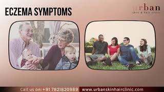 What Is Eczema Causes Symptoms amp Effective Treatment On Eczema Urban Skin amp Hair Clinic In Pune [upl. by Aranahs]