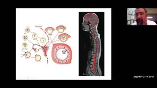 Session 21 on Cerebrospinal Fluid CSF Awakening Awareness with Mauro Zappaterra MD PhD [upl. by Yeldoow]