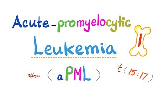 Acute Promyelocytic Leukema aPML  AML M3 Subtype  t1517  Vitamin A ATRA  Hematology [upl. by Ramoj]