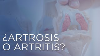 ¿Artrosis o artritis  Diferencia entre artritis y artrosis [upl. by Zusman]