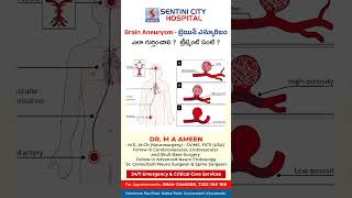 Brain Aneurysm  Symptoms amp Treatment  Sentini City Hospital shorts sentinicityhospital [upl. by Coheman883]