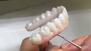 Implant Bridges Zirconia Monolithic Double Full Arch Tutorial [upl. by Bassett]