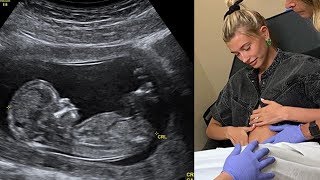 BREAKING Justin Bieber amp Hailey Baldwin Share Pregnancy News [upl. by Kline215]