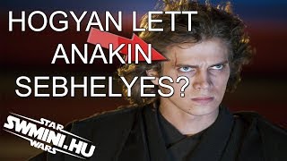 Hogyan lett Anakin sebhelyes  Star Wars InfĂłmorzsa [upl. by Alig]