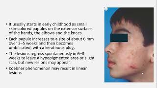 Lecture149 Perforating Dermatoses Rooks Chapter 96 [upl. by Stalker]