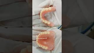 Complete denture restoring old smiles removable [upl. by Eidlog466]