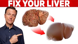 The 6 Best Ways to Heal a Fatty Liver [upl. by Etterb]