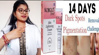 Skin whitening cream  Kojiglo Forte Skin lightening cream honest review in hindi  Kojiglo Cream [upl. by Gnilrits]