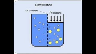 10 28 22 Ultrafiltration in hemodialysis patients [upl. by Nibot]