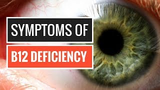 5 Signs and Symptoms of Vitamin B12 Deficiency [upl. by Daile]