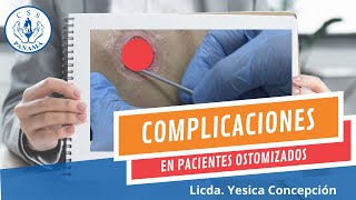 COMPLICACIONES EN PACIENTES CON OSTOMÍAS [upl. by Reimer]