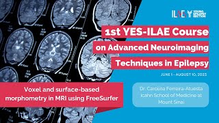 4th Lecture Surfacebased morphometry in MRI using FreeSurfer [upl. by Eisaj123]