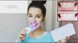 HOW I KEEP MY TEETH WHITE  HISMILE TEETH WHITENING [upl. by Elyod]