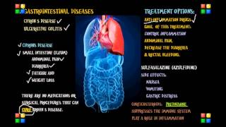 NCLEX Review on the Gastro Diseases Chrons Ulcerative [upl. by Eibloc170]