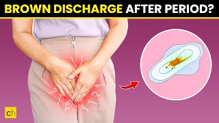 How To Stop Brown Discharge After Period  Causes amp Natural Remedies [upl. by Ahsinyar]