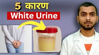 White Urine is Good or Bad  White Urine Means  urineproblem  mayankjaiswal [upl. by Elkraps]