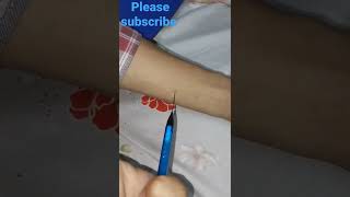 Injection 💉 using pen pencil ✏🤩 Hack version shorts [upl. by Anura]