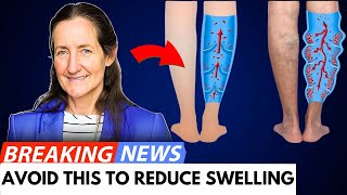 Barbara ONeills Natural Remedies For Swollen Legs and Feet That Works INSTANTLY [upl. by Nafets]