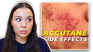 My 12 MONTHS Accutane SIDE EFFECT Timeline [upl. by Ahsiuqat]