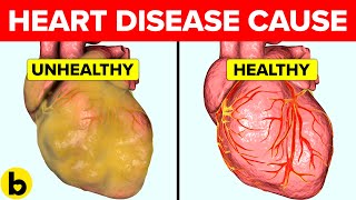 What Causes Heart Disease and How Can You Prevent It [upl. by Uhthna]