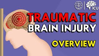 Overview of Traumatic Brain Injury TBI [upl. by Hudnut]