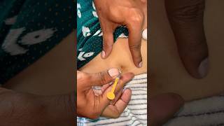 How to give SC injection 💉😱docter trendingshorts viralshorts [upl. by Terence]