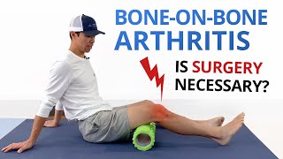 Bone on Bone Osteoarthritis Knee Pain Exercises amp Treatment Options [upl. by Berkley]