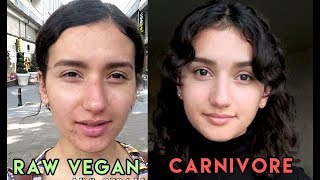 Raw Vegan Diets Are Unhealthy  My Experience [upl. by Wallraff]