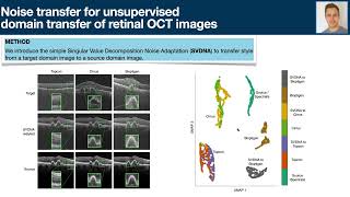 MICCAI 2022  Noise Transfer for Unsupervised Domain Adaptation of Retinal OCT Images [upl. by Leur]