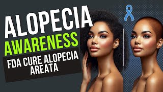 The FDA APPROVED Solution to Alopecia Areata Treatment [upl. by Rabma]