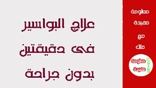 علاج البواسير خلال دقيقتين فقط  بدون جراحة،علاج البواسير الداخلية والخارجية مجربة وفعالة مع ملك [upl. by Rumit38]