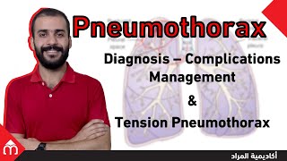 02 Pneumothorax  استرواح الصدر [upl. by Aem526]