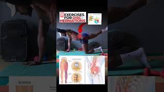 9 Effective herniated disc exercises and stretches herniateddisc herniarepair stretches [upl. by Akinom]