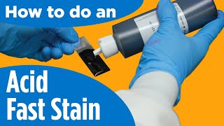 How to do an AcidFast Stain  Instructions for the labprocedure [upl. by Libb325]