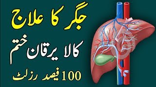 Jigar Ka Desi Ilaj  Kala Yarqan Ka Ilaj Treatment For Hepatitise C amp B In UrduHindi [upl. by Eustache]